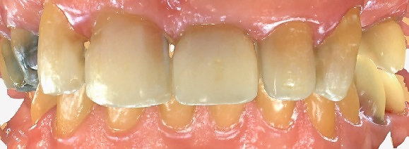 Plaza Pointe Dental Specialists treatments
