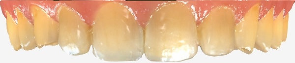 Plaza Pointe Dental Specialists