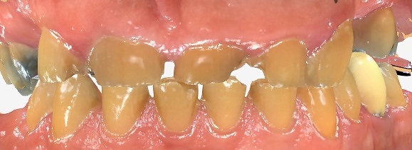 Plaza Pointe Dental Specialists - before treatment