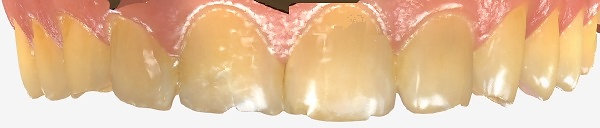 Plaza Pointe Dental Specialists before treatment
