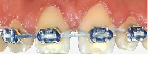 Plaza Pointe Dental Specialists - braces