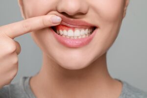 woman showing her gums